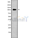 Western blot analysis USP26 using HuvEc whole cell lysates