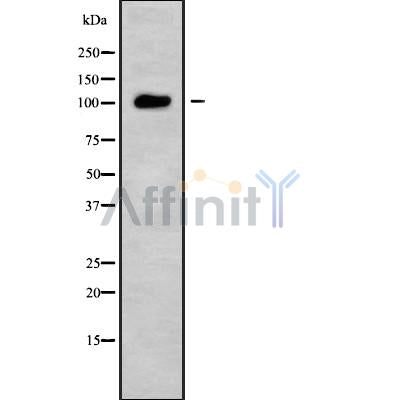 Western blot analysis USP26 using HuvEc whole cell lysates