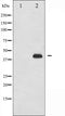 AF3167 at 1/100 staining Rat colon tissue by IHC-P. The sample was formaldehyde fixed and a heat mediated antigen retrieval step in citrate buffer was performed. The sample was then blocked and incubated with the antibody for 1.5 hours at 22¡ãC. An HRP conjugated goat anti-rabbit antibody was used as the secondary