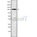 DF9987 at 1/100 staining Rat brain tissue by IHC-P. The sample was formaldehyde fixed and a heat mediated antigen retrieval step in citrate buffer was performed. The sample was then blocked and incubated with the antibody for 1.5 hours at 22¡ãC. An HRP conjugated goat anti-rabbit antibody was used as the secondary