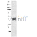 DF9988 at 1/100 staining Mouse kidney tissue by IHC-P. The sample was formaldehyde fixed and a heat mediated antigen retrieval step in citrate buffer was performed. The sample was then blocked and incubated with the antibody for 1.5 hours at 22¡ãC. An HRP conjugated goat anti-rabbit antibody was used as the secondary