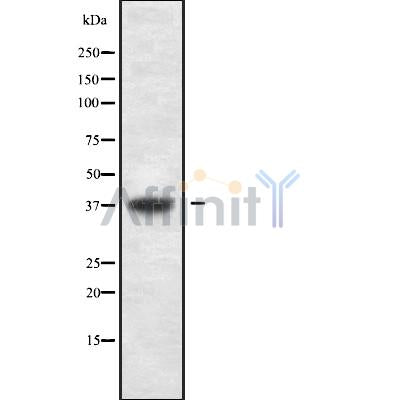 DF9988 at 1/100 staining Mouse kidney tissue by IHC-P. The sample was formaldehyde fixed and a heat mediated antigen retrieval step in citrate buffer was performed. The sample was then blocked and incubated with the antibody for 1.5 hours at 22¡ãC. An HRP conjugated goat anti-rabbit antibody was used as the secondary
