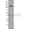 DF9989 at 1/100 staining Mouse spleen tissue by IHC-P. The sample was formaldehyde fixed and a heat mediated antigen retrieval step in citrate buffer was performed. The sample was then blocked and incubated with the antibody for 1.5 hours at 22¡ãC. An HRP conjugated goat anti-rabbit antibody was used as the secondary