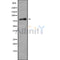 DF9993 at 1/100 staining Human spleen tissue by IHC-P. The sample was formaldehyde fixed and a heat mediated antigen retrieval step in citrate buffer was performed. The sample was then blocked and incubated with the antibody for 1.5 hours at 22¡ãC. An HRP conjugated goat anti-rabbit antibody was used as the secondary