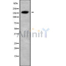 Western blot analysis USP6 using HeLa whole cell lysates