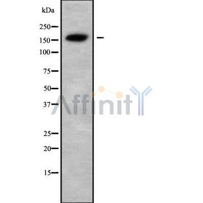 Western blot analysis USP6 using HeLa whole cell lysates