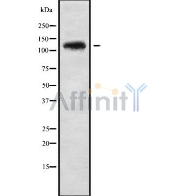 Western blot analysis UBE4A using HepG2 whole cell lysates