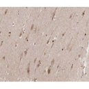 AF3168 staining Hela by IF/ICC. The sample were fixed with PFA and permeabilized in 0.1% Triton X-100,then blocked in 10% serum for 45 minutes at 25¡ãC. The primary antibody was diluted at 1/200 and incubated with the sample for 1 hour at 37¡ãC. An  Alexa Fluor 594 conjugated goat anti-rabbit IgG (H+L) Ab, diluted at 1/600, was used as the secondary antibod