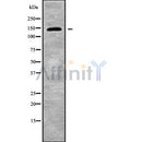Western blot analysis UBE4B using Jurkat whole cell lysates
