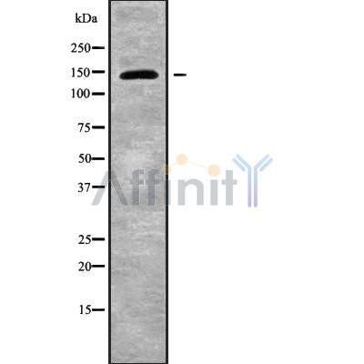 Western blot analysis UBE4B using Jurkat whole cell lysates