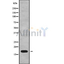 Western blot analysis UBE2A/B using LOVO whole cell lysates