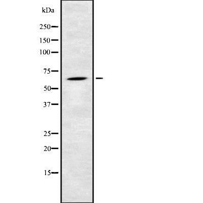 Western blot analysis of AMPKgamma2 using K562 whole cell lysates
