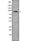 Western blot analysis of extracts from Hela, using ANKRD20 Antibody. The lane on the left was treated with blocking peptide.