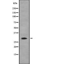 AF9010 staining COLO205 by IF/ICC. The sample were fixed with PFA and permeabilized in 0.1% Triton X-100,then blocked in 10% serum for 45 minutes at 25¡ãC. The primary antibody was diluted at 1/200 and incubated with the sample for 1 hour at 37¡ãC. An  Alexa Fluor 594 conjugated goat anti-rabbit IgG (H+L) Ab, diluted at 1/600, was used as the secondary antibod