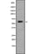 AF9020 at 1/100 staining Human Melanoma tissue by IHC-P. The sample was formaldehyde fixed and a heat mediated antigen retrieval step in citrate buffer was performed. The sample was then blocked and incubated with the antibody for 1.5 hours at 22¡ãC. An HRP conjugated goat anti-rabbit antibody was used as the secondary