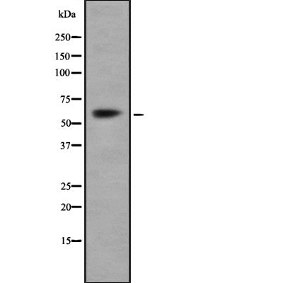 AF9020 at 1/100 staining Human Melanoma tissue by IHC-P. The sample was formaldehyde fixed and a heat mediated antigen retrieval step in citrate buffer was performed. The sample was then blocked and incubated with the antibody for 1.5 hours at 22¡ãC. An HRP conjugated goat anti-rabbit antibody was used as the secondary