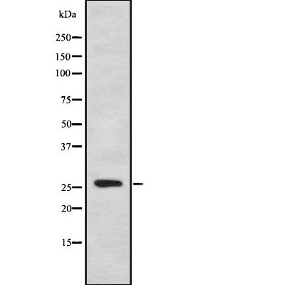 AF9022 staining Hela by IF/ICC. The sample were fixed with PFA and permeabilized in 0.1% Triton X-100,then blocked in 10% serum for 45 minutes at 25¡ãC. The primary antibody was diluted at 1/200 and incubated with the sample for 1 hour at 37¡ãC. An  Alexa Fluor 594 conjugated goat anti-rabbit IgG (H+L) Ab, diluted at 1/600, was used as the secondary antibod
