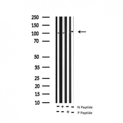 AF3171 at 1/100 staining Human liver tissue by IHC-P. The sample was formaldehyde fixed and a heat mediated antigen retrieval step in citrate buffer was performed. The sample was then blocked and incubated with the antibody for 1.5 hours at 22¡ãC. An HRP conjugated goat anti-rabbit antibody was used as the secondary