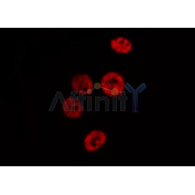AF0206 staining HeLa  cells by IF/ICC. The sample were fixed with PFA and permeabilized in 0.1% Triton X-100,then blocked in 10% serum for 45 minutes at 25¡ãC. The primary antibody was diluted at 1/200 and incubated with the sample for 1 hour at 37¡ãC. An  Alexa Fluor 594 conjugated goat anti-rabbit IgG (H+L) antibody(Cat.
