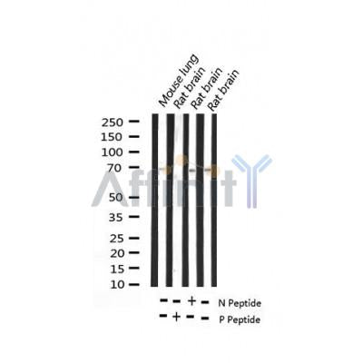 AF3172 staining 293 by IF/ICC. The sample were fixed with PFA and permeabilized in 0.1% Triton X-100,then blocked in 10% serum for 45 minutes at 25¡ãC. The primary antibody was diluted at 1/200 and incubated with the sample for 1 hour at 37¡ãC. An  Alexa Fluor 594 conjugated goat anti-rabbit IgG (H+L) Ab, diluted at 1/600, was used as the secondary antibod