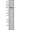 Western blot analysis of Centrobin using Jurkat whole cell lysates