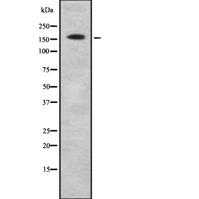 AF9045 at 1/100 staining Human Melanoma tissue by IHC-P. The sample was formaldehyde fixed and a heat mediated antigen retrieval step in citrate buffer was performed. The sample was then blocked and incubated with the antibody for 1.5 hours at 22¡ãC. An HRP conjugated goat anti-rabbit antibody was used as the secondary
