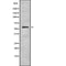Western blot analysis of CYP4F2 using HeLa whole cell lysates
