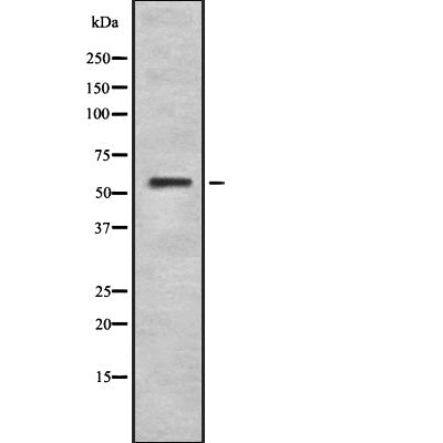 Western blot analysis of CYP4F2 using HeLa whole cell lysates
