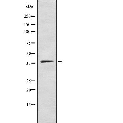 AF9054 staining COLO205 by IF/ICC. The sample were fixed with PFA and permeabilized in 0.1% Triton X-100,then blocked in 10% serum for 45 minutes at 25¡ãC. The primary antibody was diluted at 1/200 and incubated with the sample for 1 hour at 37¡ãC. An  Alexa Fluor 594 conjugated goat anti-rabbit IgG (H+L) Ab, diluted at 1/600, was used as the secondary antibod