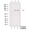 AF3174 staining 293 by IF/ICC. The sample were fixed with PFA and permeabilized in 0.1% Triton X-100,then blocked in 10% serum for 45 minutes at 25¡ãC. The primary antibody was diluted at 1/200 and incubated with the sample for 1 hour at 37¡ãC. An  Alexa Fluor 594 conjugated goat anti-rabbit IgG (H+L) Ab, diluted at 1/600, was used as the secondary antibod