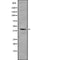 AF9064 staining HepG2 by IF/ICC. The sample were fixed with PFA and permeabilized in 0.1% Triton X-100,then blocked in 10% serum for 45 minutes at 25¡ãC. The primary antibody was diluted at 1/200 and incubated with the sample for 1 hour at 37¡ãC. An  Alexa Fluor 594 conjugated goat anti-rabbit IgG (H+L) Ab, diluted at 1/600, was used as the secondary antibod