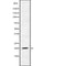 AF9066 at 1/100 staining Human Melanoma tissue by IHC-P. The sample was formaldehyde fixed and a heat mediated antigen retrieval step in citrate buffer was performed. The sample was then blocked and incubated with the antibody for 1.5 hours at 22¡ãC. An HRP conjugated goat anti-rabbit antibody was used as the secondary
