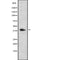 AF9069 at 1/100 staining Human liver cancer tissue by IHC-P. The sample was formaldehyde fixed and a heat mediated antigen retrieval step in citrate buffer was performed. The sample was then blocked and incubated with the antibody for 1.5 hours at 22¡ãC. An HRP conjugated goat anti-rabbit antibody was used as the secondary
