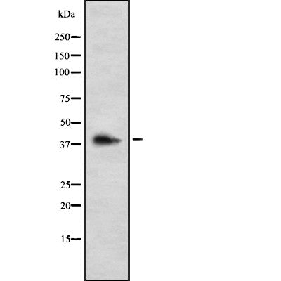 AF9069 at 1/100 staining Human liver cancer tissue by IHC-P. The sample was formaldehyde fixed and a heat mediated antigen retrieval step in citrate buffer was performed. The sample was then blocked and incubated with the antibody for 1.5 hours at 22¡ãC. An HRP conjugated goat anti-rabbit antibody was used as the secondary