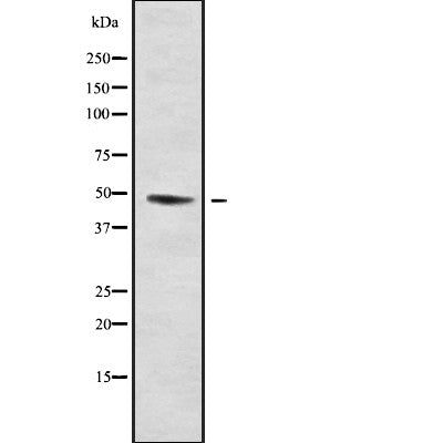 Western blot analysis GRIN2 using K562 whole cell lysates