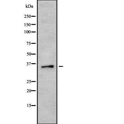AF9092 staining Hela by IF/ICC. The sample were fixed with PFA and permeabilized in 0.1% Triton X-100,then blocked in 10% serum for 45 minutes at 25¡ãC. The primary antibody was diluted at 1/200 and incubated with the sample for 1 hour at 37¡ãC. An  Alexa Fluor 594 conjugated goat anti-rabbit IgG (H+L) Ab, diluted at 1/600, was used as the secondary antibod