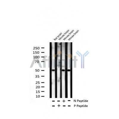 AF3178 staining Hela by IF/ICC. The sample were fixed with PFA and permeabilized in 0.1% Triton X-100,then blocked in 10% serum for 45 minutes at 25¡ãC. The primary antibody was diluted at 1/200 and incubated with the sample for 1 hour at 37¡ãC. An  Alexa Fluor 594 conjugated goat anti-rabbit IgG (H+L) Ab, diluted at 1/600, was used as the secondary antibod
