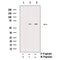 AF3181 staining Hela by IF/ICC. The sample were fixed with PFA and permeabilized in 0.1% Triton X-100,then blocked in 10% serum for 45 minutes at 25¡ãC. The primary antibody was diluted at 1/200 and incubated with the sample for 1 hour at 37¡ãC. An  Alexa Fluor 594 conjugated goat anti-rabbit IgG (H+L) Ab, diluted at 1/600, was used as the secondary antibod