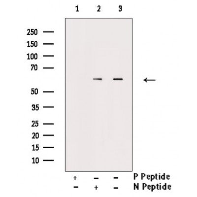AF3181 staining Hela by IF/ICC. The sample were fixed with PFA and permeabilized in 0.1% Triton X-100,then blocked in 10% serum for 45 minutes at 25¡ãC. The primary antibody was diluted at 1/200 and incubated with the sample for 1 hour at 37¡ãC. An  Alexa Fluor 594 conjugated goat anti-rabbit IgG (H+L) Ab, diluted at 1/600, was used as the secondary antibod