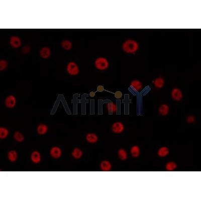 AF0207 staining HepG2 by IF/ICC. The sample were fixed with PFA and permeabilized in 0.1% Triton X-100,then blocked in 10% serum for 45 minutes at 25¡ãC. The primary antibody was diluted at 1/200 and incubated with the sample for 1 hour at 37¡ãC. An  Alexa Fluor 594 conjugated goat anti-rabbit IgG (H+L) Ab, diluted at 1/600, was used as the secondary antibod