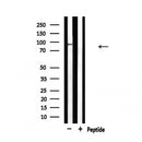 Western blot analysis of extracts from HepG2, using MCM5 Antibody.