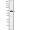 AF9175 staining 293 by IF/ICC. The sample were fixed with PFA and permeabilized in 0.1% Triton X-100,then blocked in 10% serum for 45 minutes at 25¡ãC. The primary antibody was diluted at 1/200 and incubated with the sample for 1 hour at 37¡ãC. An  Alexa Fluor 594 conjugated goat anti-rabbit IgG (H+L) Ab, diluted at 1/600, was used as the secondary antibod