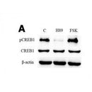 AF3188 staining HeLa by IF/ICC. The sample were fixed with PFA and permeabilized in 0.1% Triton X-100,then blocked in 10% serum for 45 minutes at 25¡ãC. The primary antibody was diluted at 1/200 and incubated with the sample for 1 hour at 37¡ãC. An  Alexa Fluor 594 conjugated goat anti-rabbit IgG (H+L) Ab, diluted at 1/600, was used as the secondary antibod