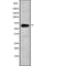 AF9202 staining HuvEc by IF/ICC. The sample were fixed with PFA and permeabilized in 0.1% Triton X-100,then blocked in 10% serum for 45 minutes at 25¡ãC. The primary antibody was diluted at 1/200 and incubated with the sample for 1 hour at 37¡ãC. An  Alexa Fluor 594 conjugated goat anti-rabbit IgG (H+L) Ab, diluted at 1/600, was used as the secondary antibod