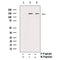 Phospho-PDGFRa (Tyr849) Antibody