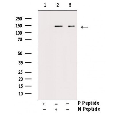 Phospho-PDGFRa (Tyr849) Antibody