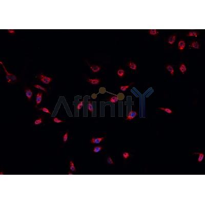 AF0208 staining U-2 OS cells by IF/ICC. The sample were fixed with PFA and permeabilized in 0.1% Triton X-100,then blocked in 10% serum for 45 minutes at 25¡ãC. The primary antibody was diluted at 1/200 and incubated with the sample for 1 hour at 37¡ãC. An  Alexa Fluor 594 conjugated goat anti-rabbit IgG (H+L) antibody(Cat.