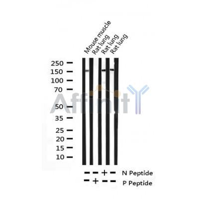 AF3192 staining HepG2 cells by IF/ICC. The sample were fixed with PFA and permeabilized in 0.1% Triton X-100,then blocked in 10% serum for 45 minutes at 25¡ãC. The primary antibody was diluted at 1/200 and incubated with the sample for 1 hour at 37¡ãC. An  Alexa Fluor 594 conjugated goat anti-rabbit IgG (H+L) antibody(Cat.
