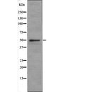 SLC1A5 antibody  at 1 ¦Ìg/ml + Jurkat (Human T cell lymphoblast-like cell line) Whole Cell Lysate