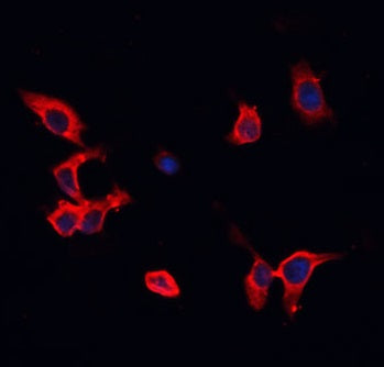 Goat Anti-Mouse IgG(H+L) Alexa Fluor 594–conjugated